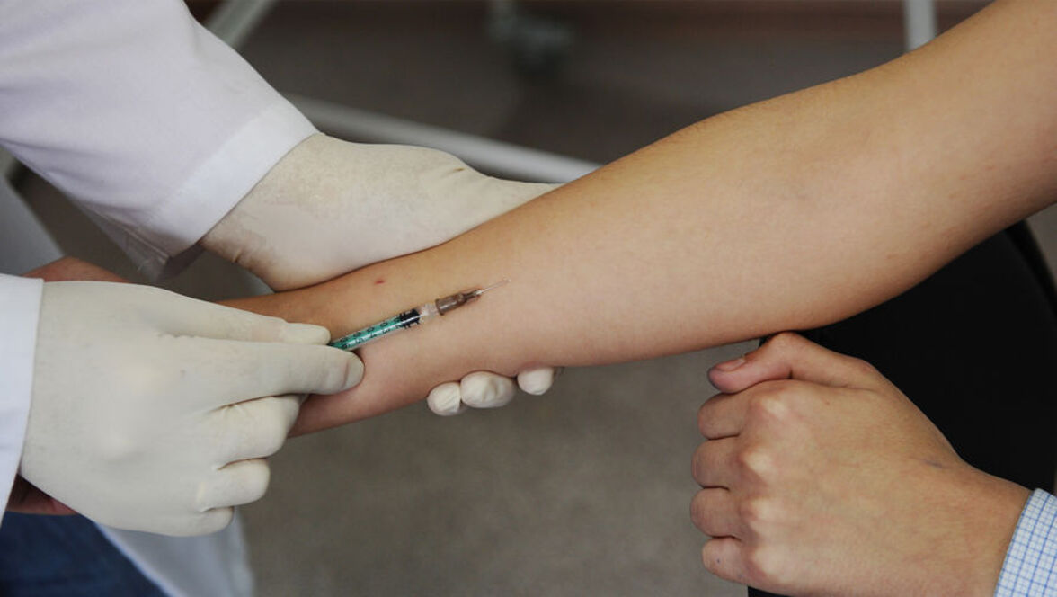 НИИ эпидемиологии и микробиологии имени Пастера завершили испытания кожного теста для оценки наличия клеточного иммунитета к SARS-CoV-2