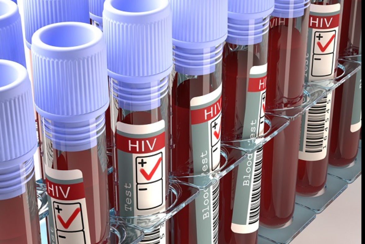 Утвержден новый стандарт медпомощи взрослым при ВИЧ-инфекции