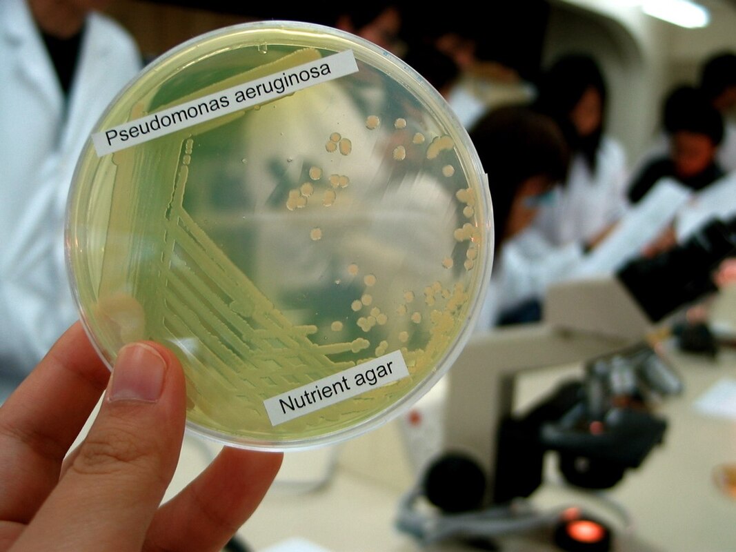 Современные представления о Pseudomonas aeruginosa: эпидемиология, вирулентность и современные стратегии борьбы с патогенами с множественной лекарственной резистентностью (MDR)