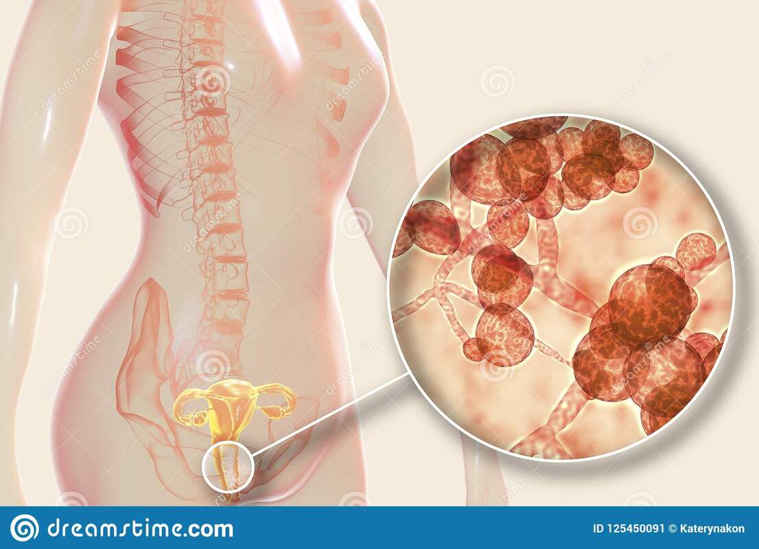 Исследование показывает рост числа резистентных к флуконазолу вагинальных инфекций C. albicans