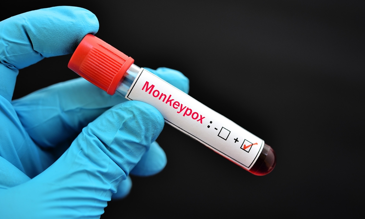 Не упускать из виду сдерживание распространения оспы обезьян