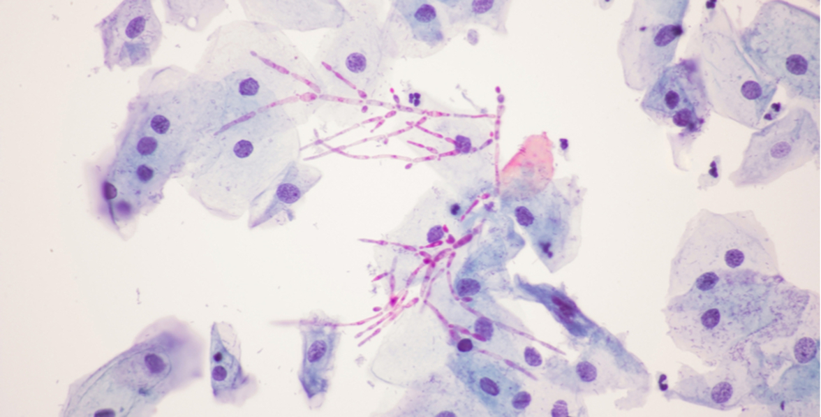 Открытие может привести к разработке новых противогрибковых препаратов