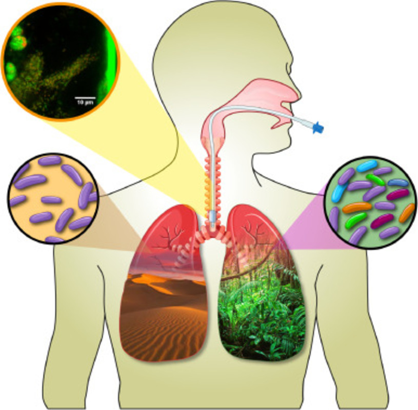 Нормальная респираторная микробиота при здоровье и заболеваниях