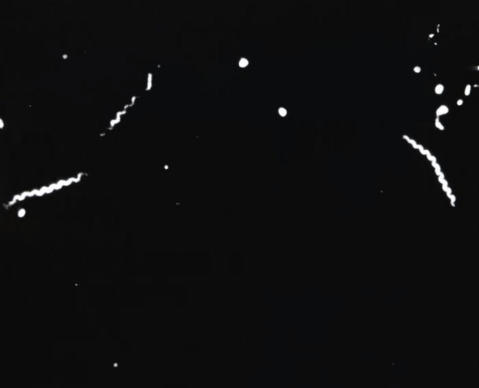 Краткая история лабораторной диагностики сифилиса