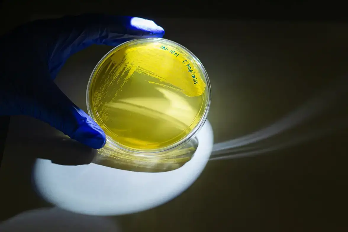 Ускоряют ли грибки, скрывающиеся в раковых опухолях, их рост?