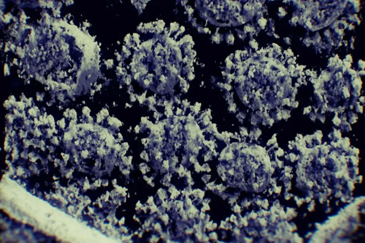 SARS-CoV-2 инфицирует жировую ткань, что, возможно, объясняет ожирение как фактор риска