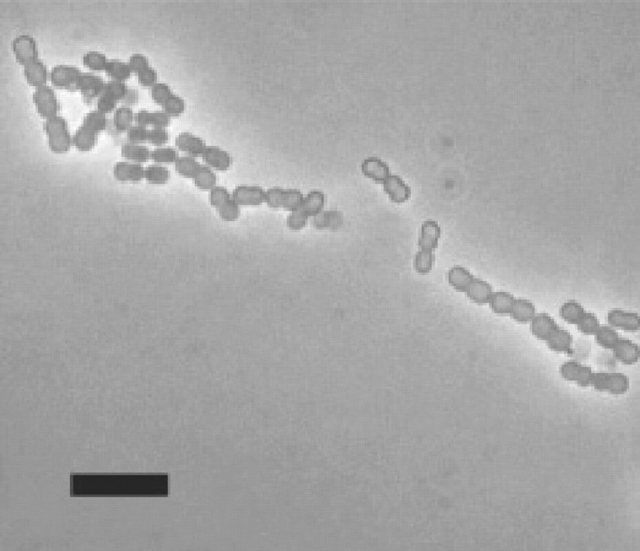 Дисбиоз кишечника и воспалительные маркеры крови предшествуют ВИЧ с ограниченными изменениями после ранней сероконверсии