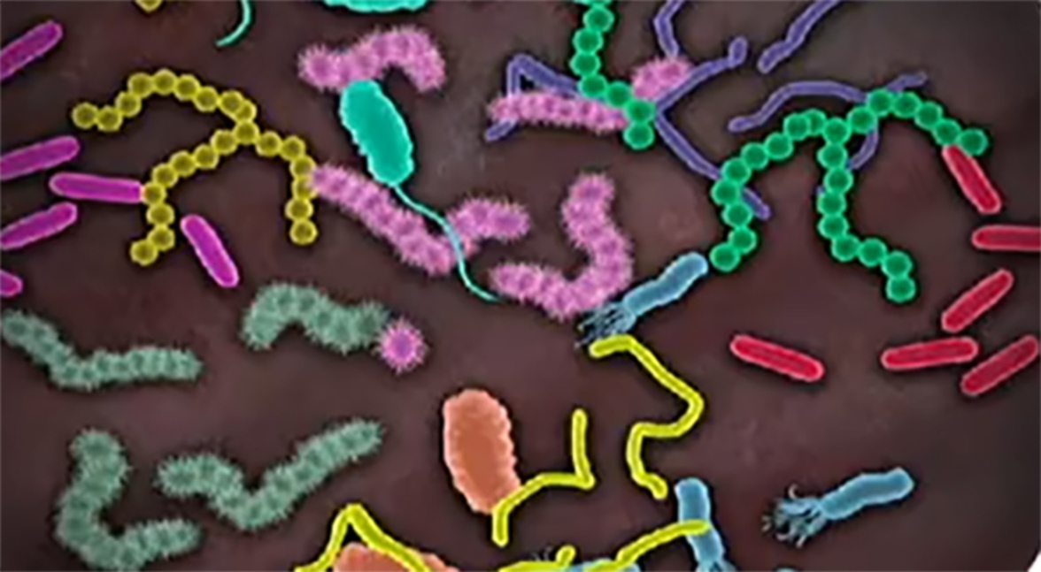 Прогресс в исследовании влияния микробиоты кишечника и опухоли на противоопухолевую эффективность и побочные эффекты химиотерапевтических препаратов