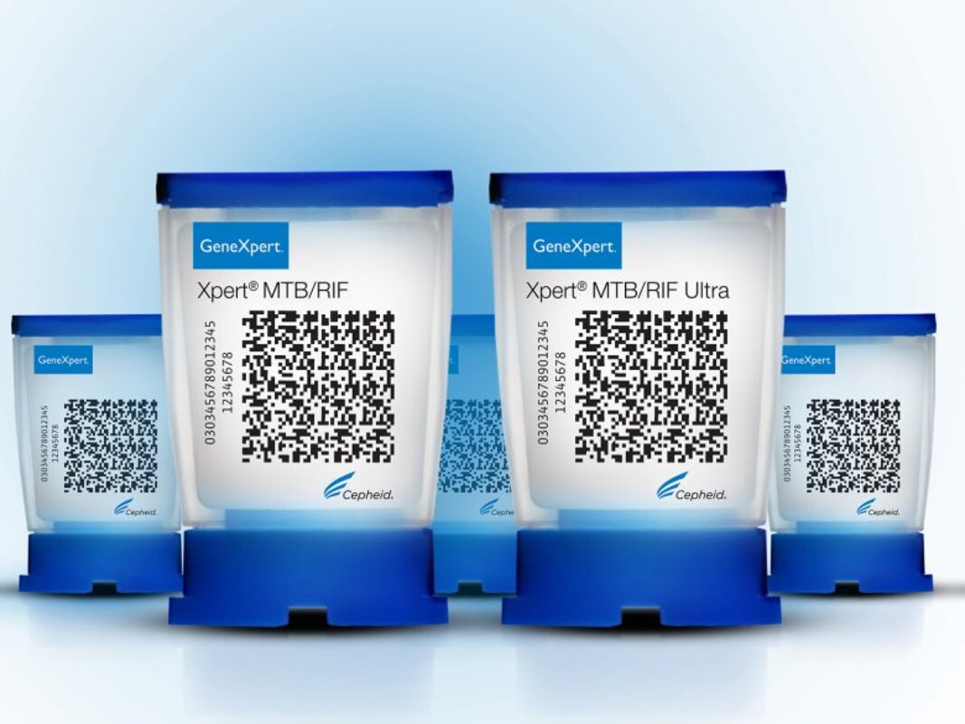 Новый метод тестирования может упростить скрининг туберкулеза