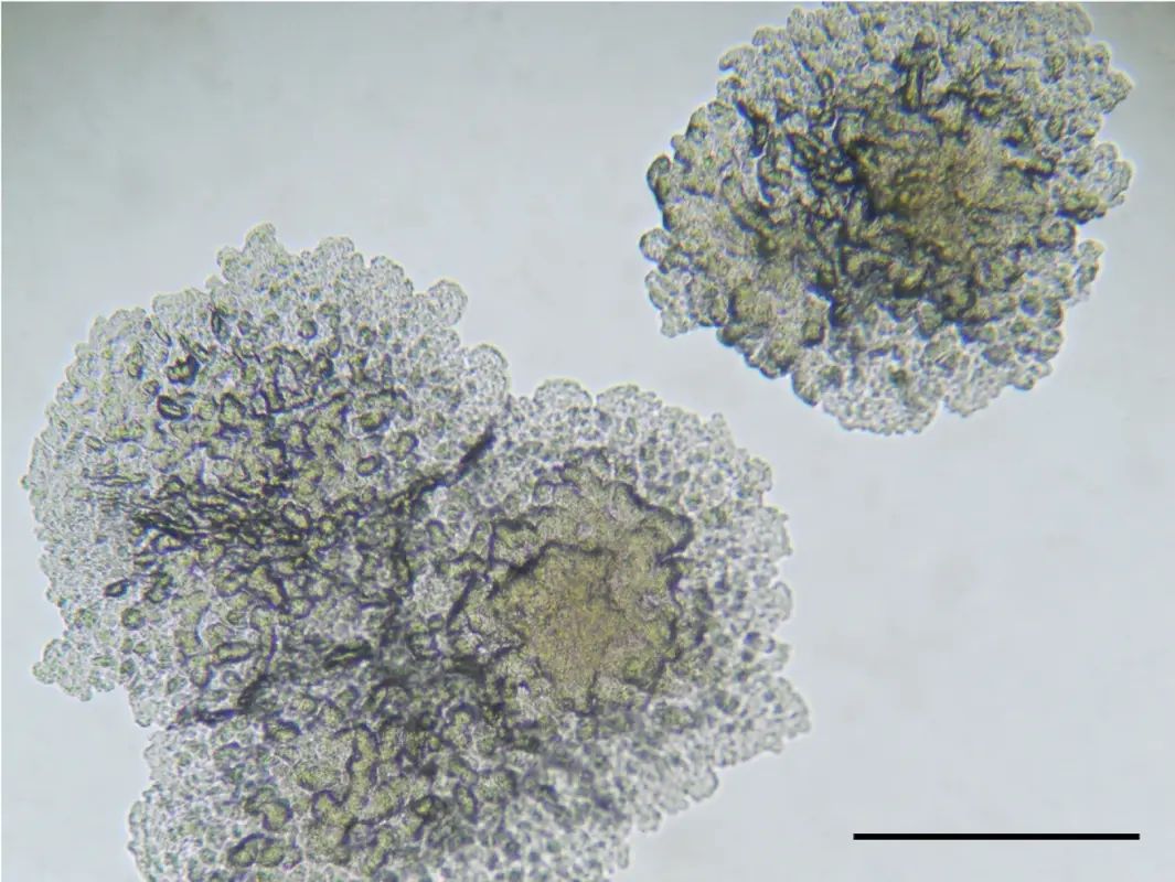 Эффективность липидных фингерпринтов с помощью рутинного MALDI-ToF для диагностики видов комплекса Mycobacterium tuberculosis