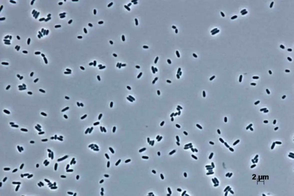 Подавляющий аппетит пробиотик помогает людям с избыточным весом сбросить вес