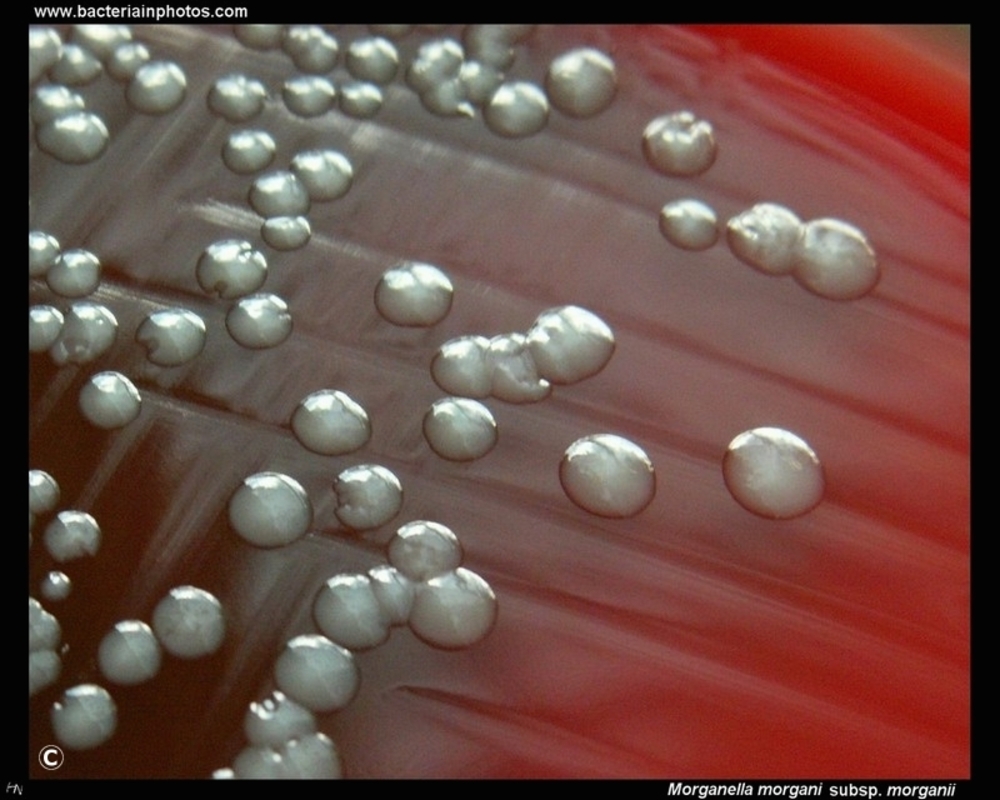 Комменсальная микробиота пациентов с воспалительными заболеваниями кишечника продуцирует генотоксические метаболиты