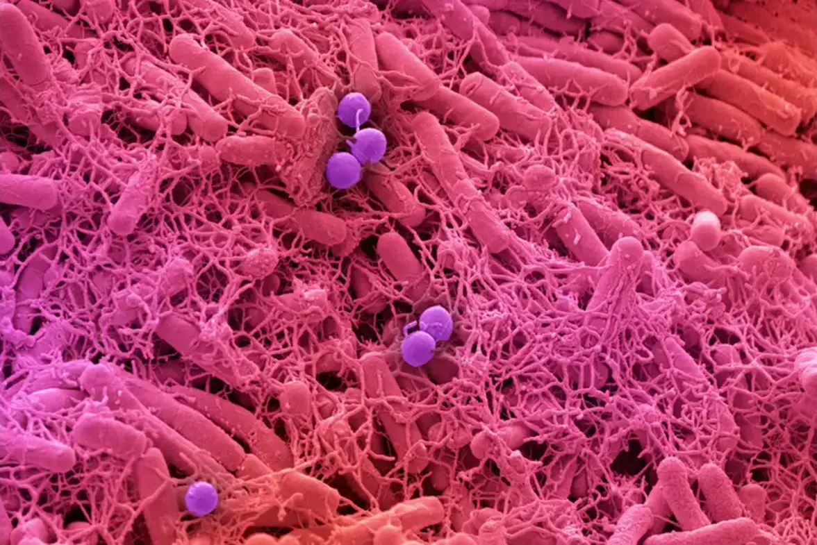 Кожные бактерии могут провоцировать возникновение волчанки