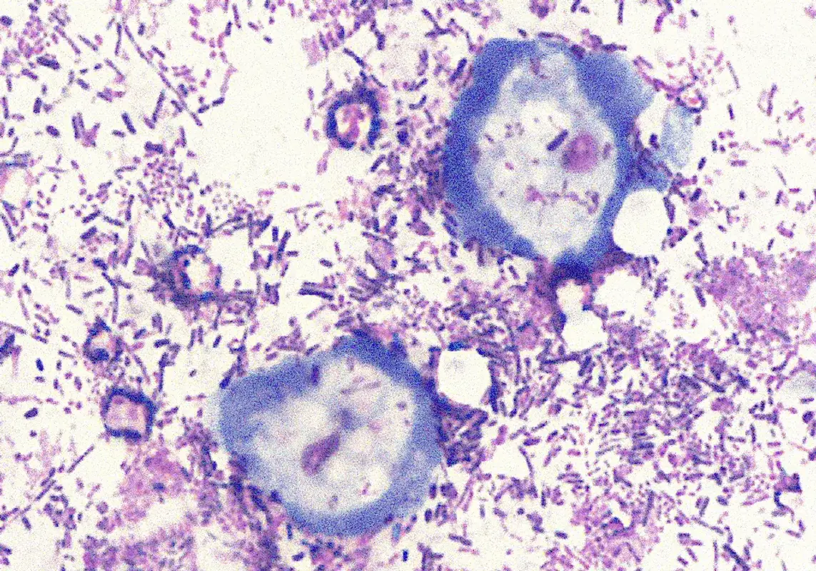 Недавно открытое семейство вирусов инфицирует простейших полости рта человека