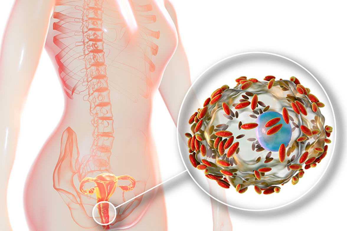 Рецидивирующие инфекции мочевыводящих путей и эстроген определяют таксономическую экологию и функциональный потенциал урогенитального микробиома в постменопаузе