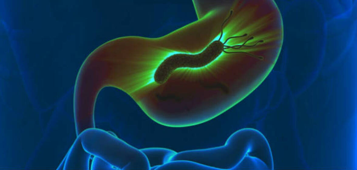 Инфекция Helicobacter pylori: патогенез, резистентность к антибиотикам, достижения и новые стратегии терапии