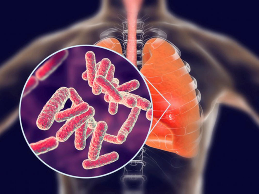 Mycobacterium tuberculosis захватывает убиквитин для подавления пироптоза