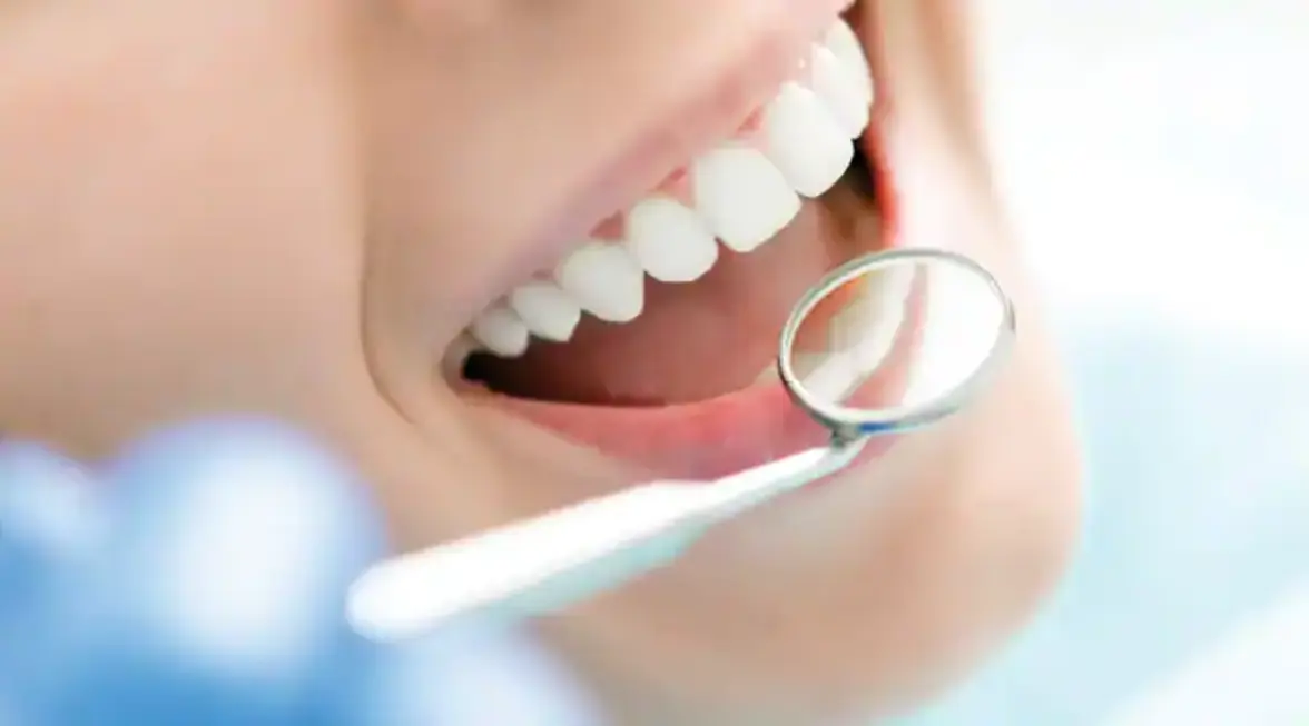 Пробиотики в лечении гингивита и пародонтита