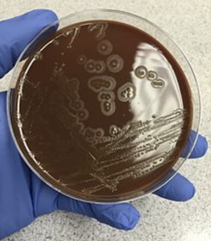 Микроорганизмы HACEK