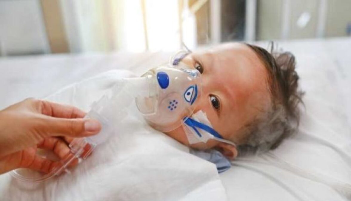 Новые предикторы тяжелых респираторно-синцитиальных вирусных инфекций среди новорожденных в возрасте до одного года