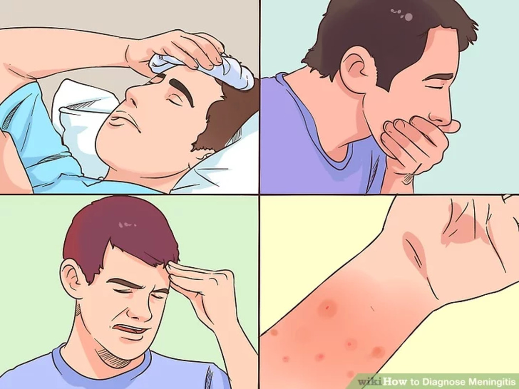 Взрослые и дети в большинстве случаев имеют только один из классической "триады" симптомов менингита, показало исследование