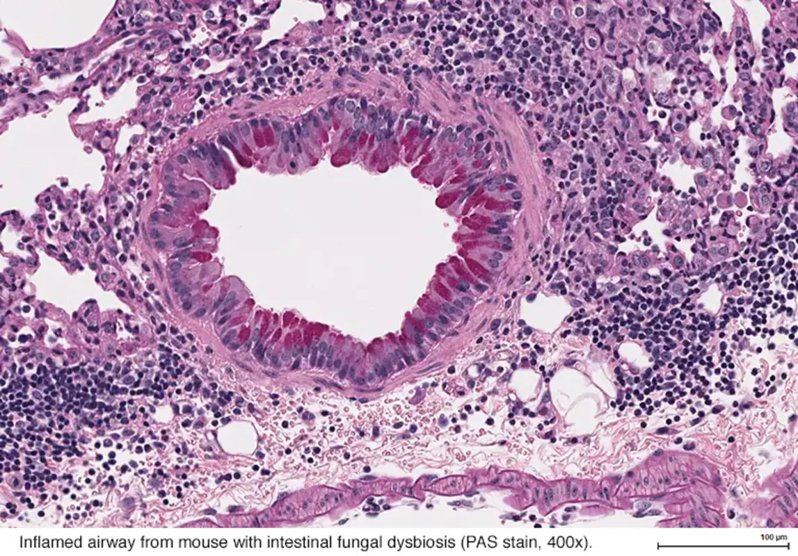 Ось взаимодействия кишечник-легкие
