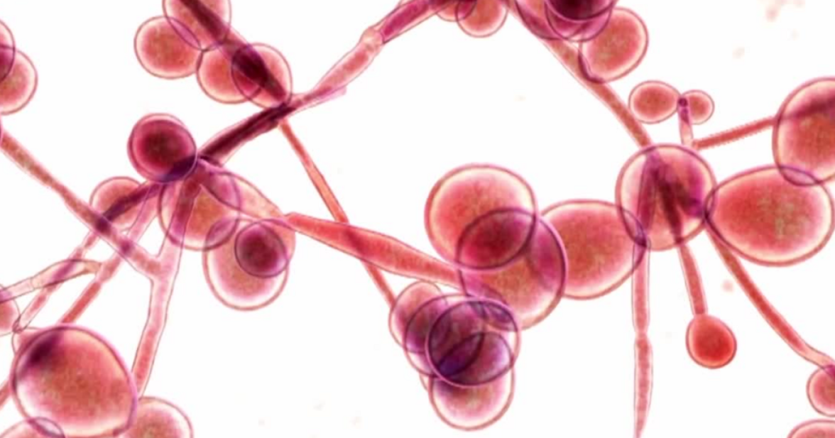 Выявление и устранение толерантности к противогрибковым препаратам у Candida auris