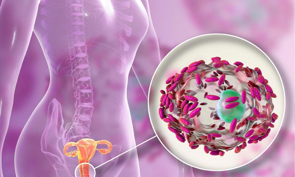 Влияние рецидивирующего бактериального вагиноза на качество жизни и потребность в доступных альтернативных методах лечения