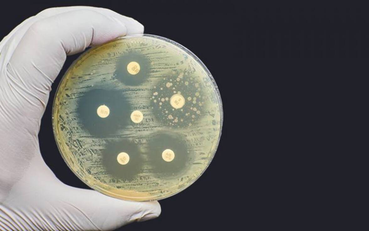 Эволюция резистентности к антибиотикам ассоциируется с коллатеральными лекарственными фенотипами у Mycobacterium tuberculosis