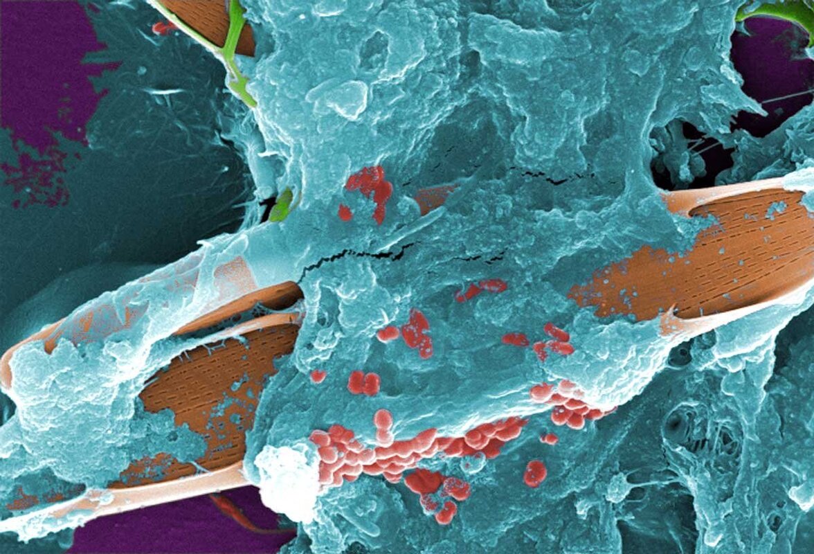 Изучение того, как поверхностные факторы влияют на образование биопленок в присутствии антибиотиков