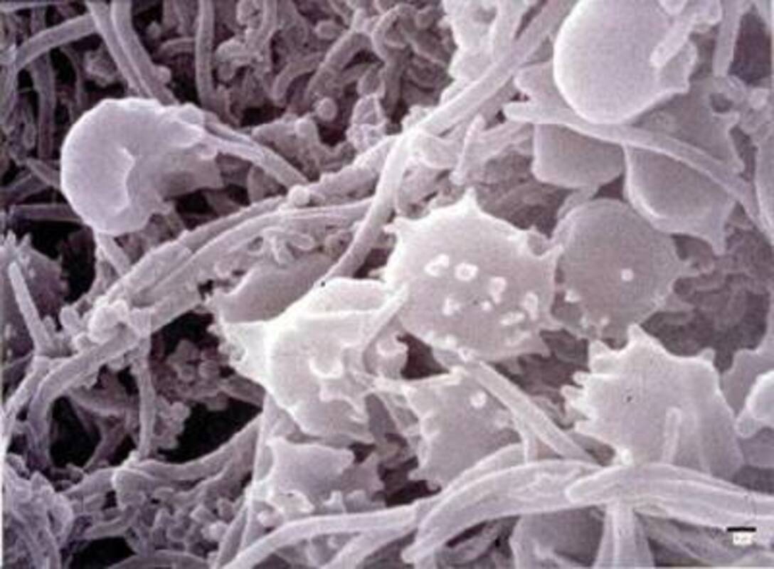 Механизмы формирования биопленок и антибиопленочные стратегии