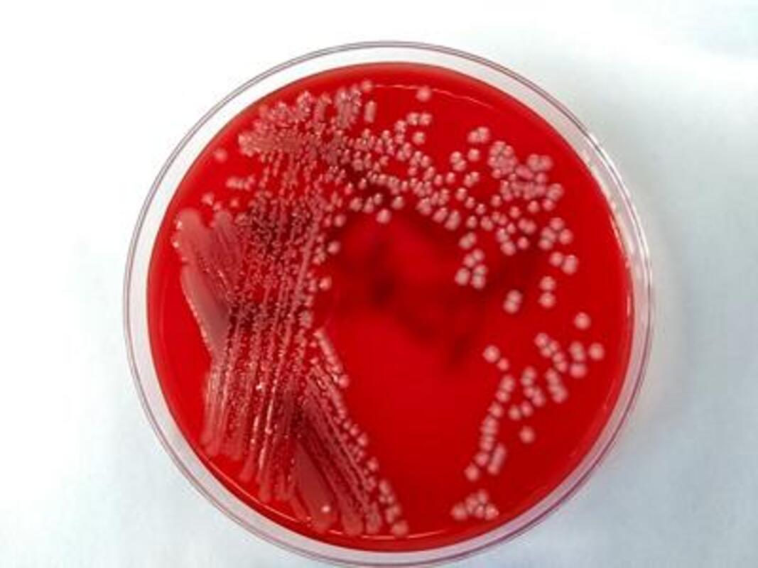 Комитет FDA единогласно рекомендовал антибиотик для лечения пневмонии у взрослых
