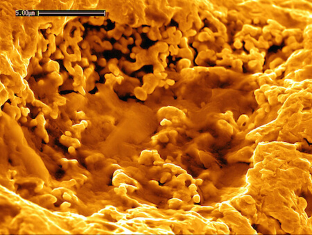 Металлофилы и их применение в биоремедиации