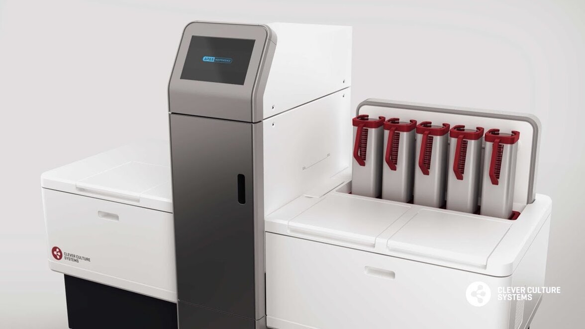 Автоматизированная система считывания чашек с культурами мочи может повысить эффективность рабочего процесса