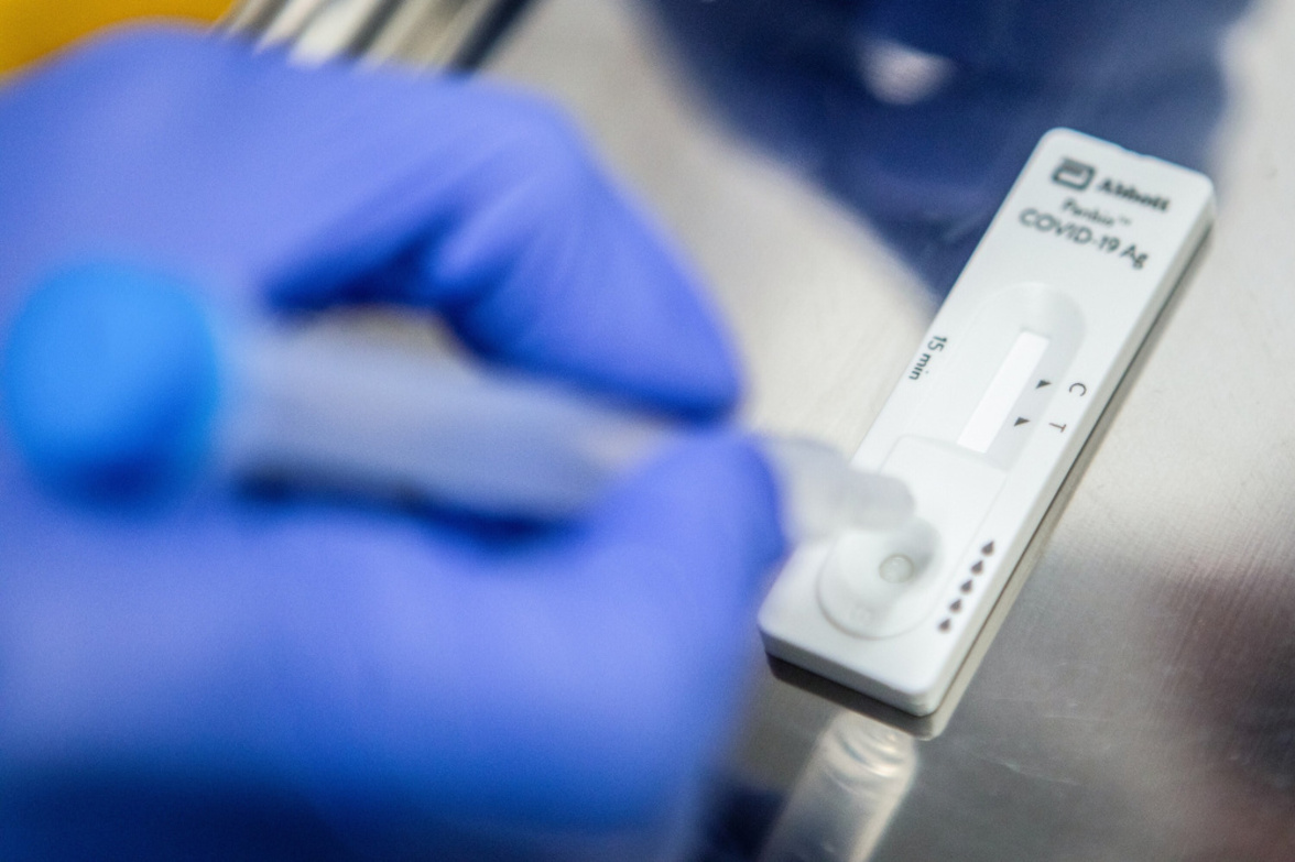 Роспотребнадзор отменил нормативы по тестированию населения на COVID-19