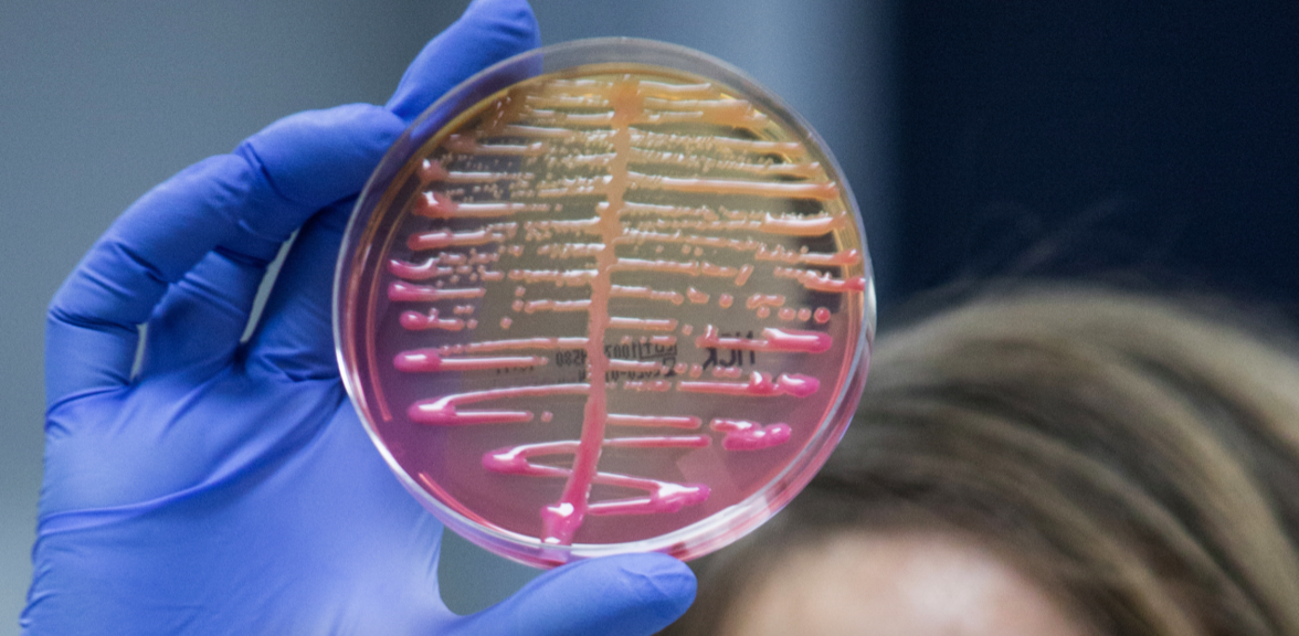 Клинико-биологическое и геномное сравнение карбапенем-резистентных Klebsiella pneumoniae с трансформацией чувствительности к полимиксину В в процессе терапии