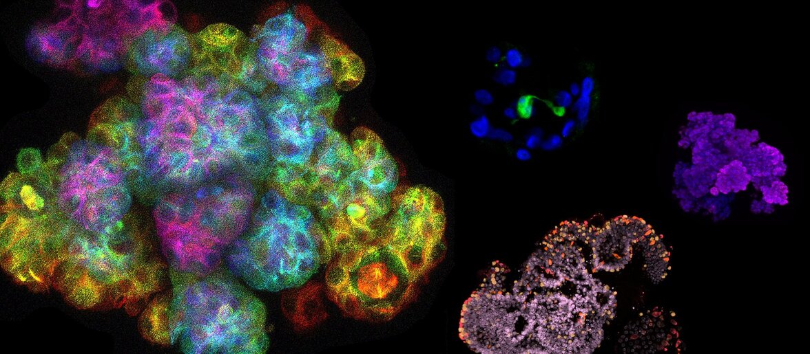 Крошечные искусственные органы могут раскрыть тайну менструации