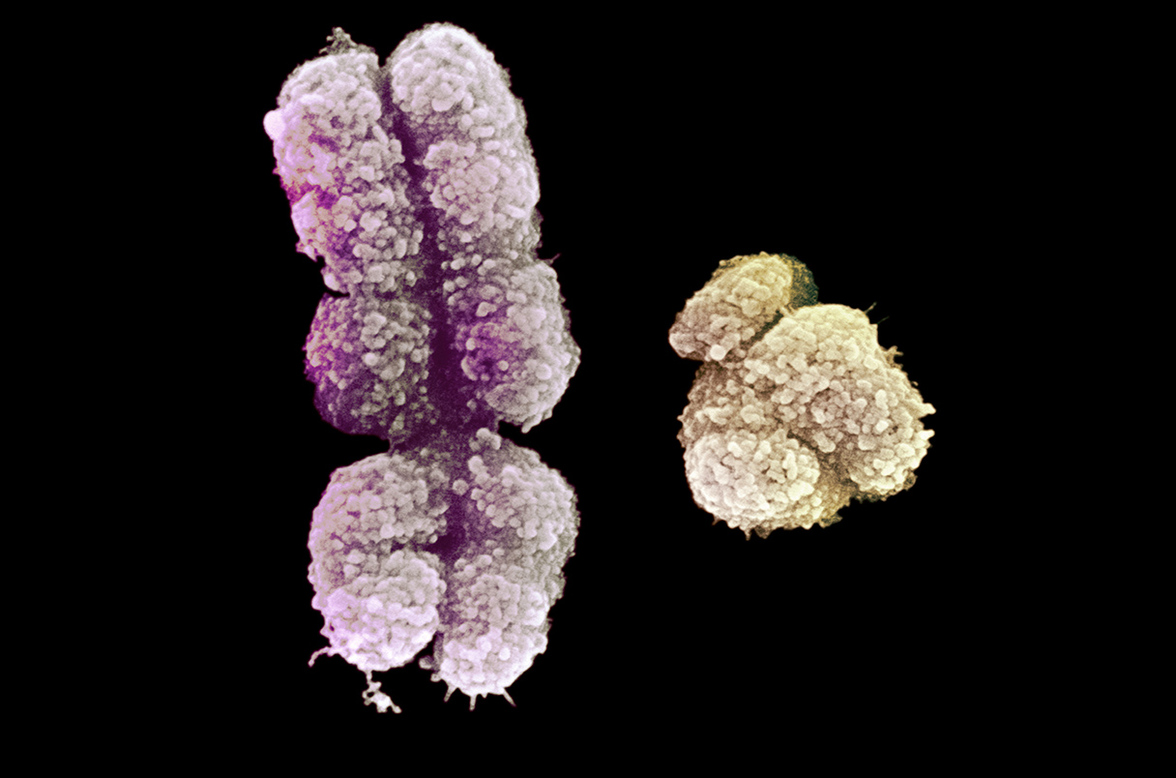 Самая "проблемная хромосома" обрела новое понимание после получения ее полной последовательности