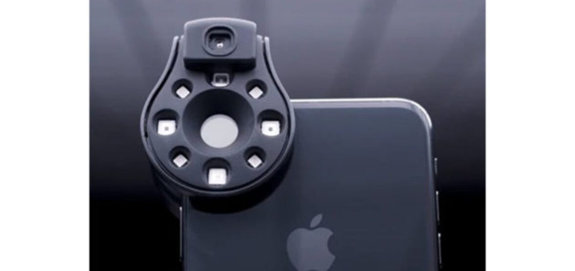 Инфицирована ли моя рана? Исследование по использованию гиперспектральной визуализации для оценки раневой инфекции