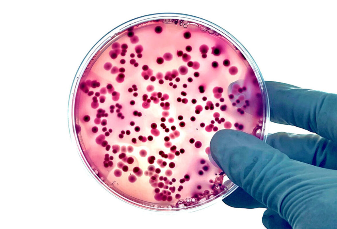 Клиническая эффективность и лекарственная резистентность цефтазидима-авибактама при лечении карбапенем-резистентных грамотрицательных бациллярных инфекций