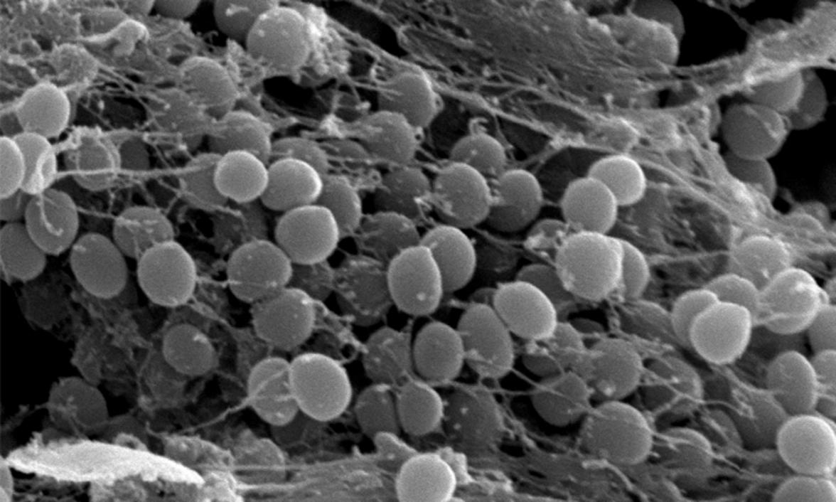 Эволюция резистентности к антимикробным препаратам в биопленке E. coli, подвергнутой воздействию высоких доз ципрофлоксацина