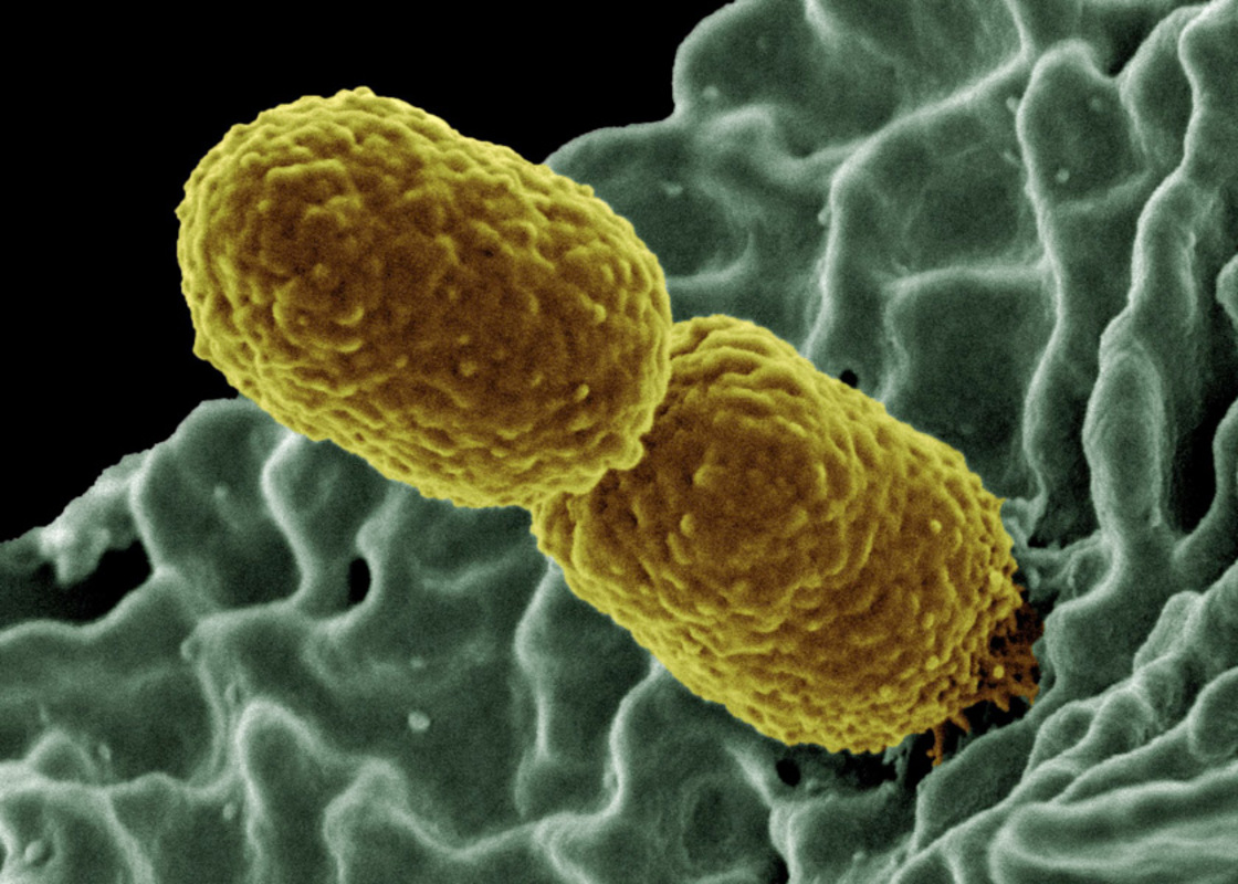Взаимодействие гипервирулентной Klebsiella pneumoniae с компонентами врожденного иммунитета человека