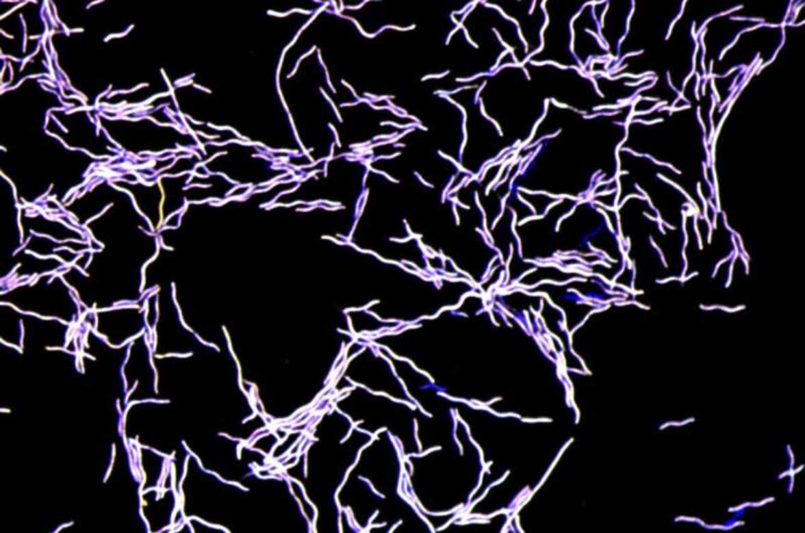 Кишечный микроорганизм вырабатывает зловонный токсичный газ, но защищает от патогенов