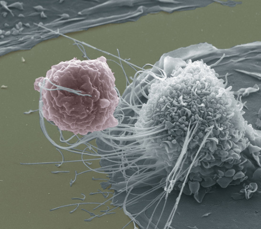 Технология биомиметического катализа  макрофагов для борьбы с антибиотикорезистентностью