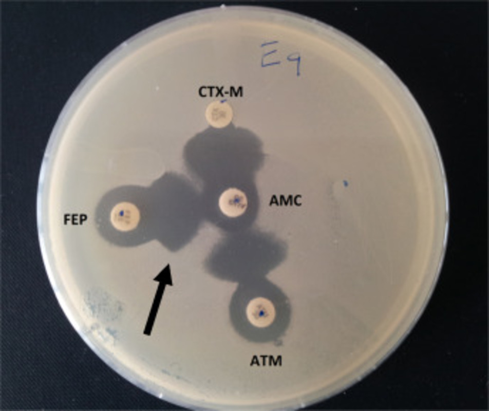 Методы обнаружения ESBL