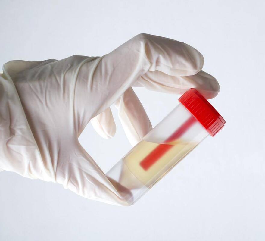 Диагностическое управление и искусственный интеллект могут улучшить лечение ИМП