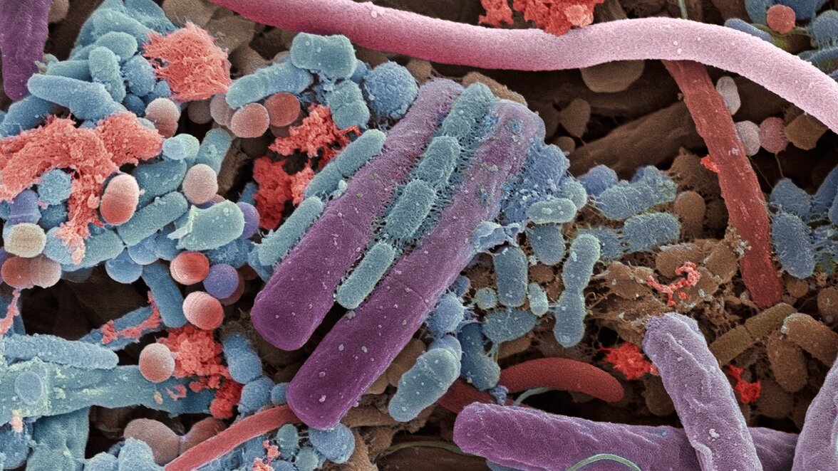 Роль микробиоты в реакции на терапию рака и восстановлении после нее