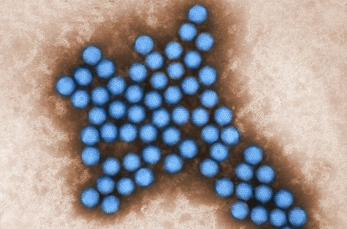 Вирусы, убивающие опухоли, демонстрируют выдающийся успех на поздних стадиях испытаний