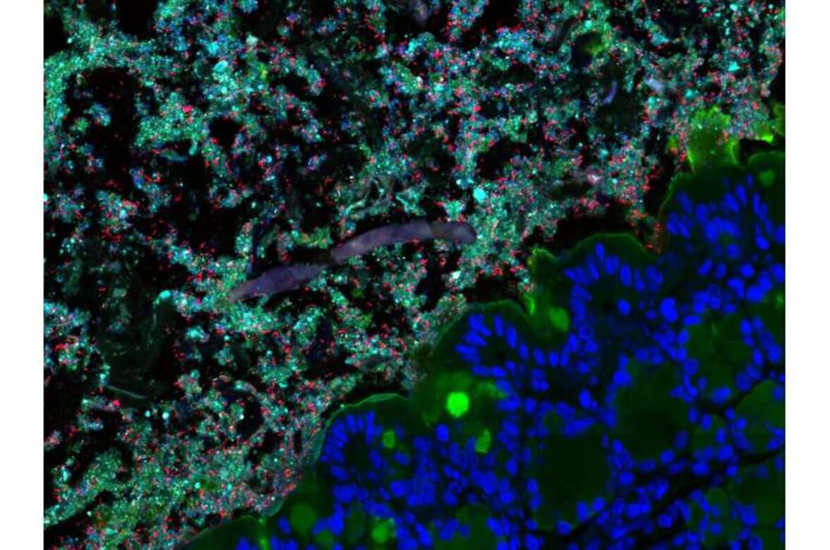 Разнообразие микробиома защищает от патогенов, блокируя питательные вещества