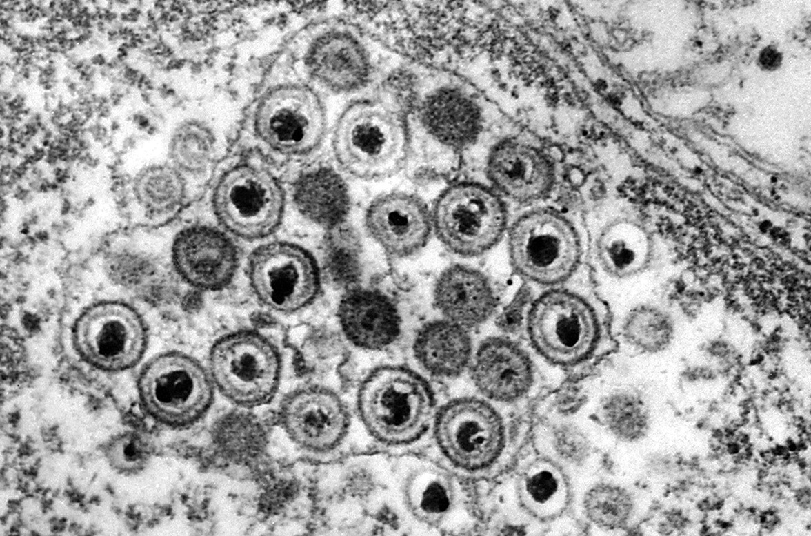 Бороться с вирусами с помощью вирусов? Генный драйв предлагает новую стратегию борьбы с инфекциями